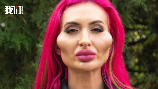 惊呆!网红模特自称拥有世界最大脸颊