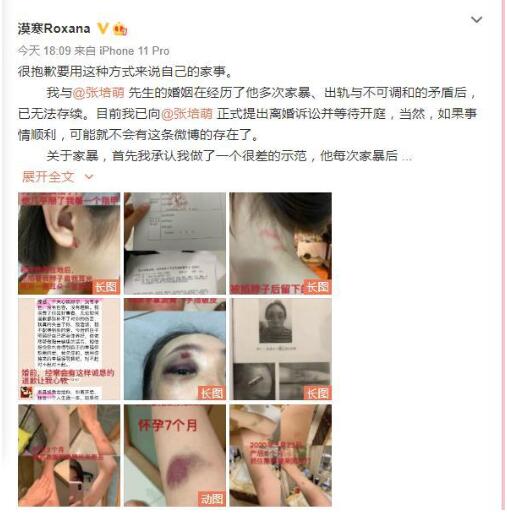 剧情反转!张培萌妻子称只想要女儿抚养权 张培萌婚内出轨抢孩子