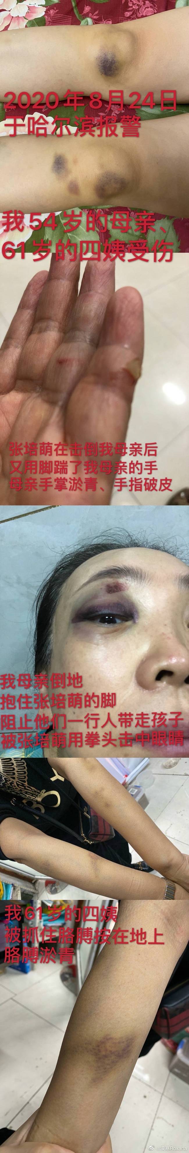 剧情反转!张培萌妻子称只想要女儿抚养权 张培萌婚内出轨抢孩子
