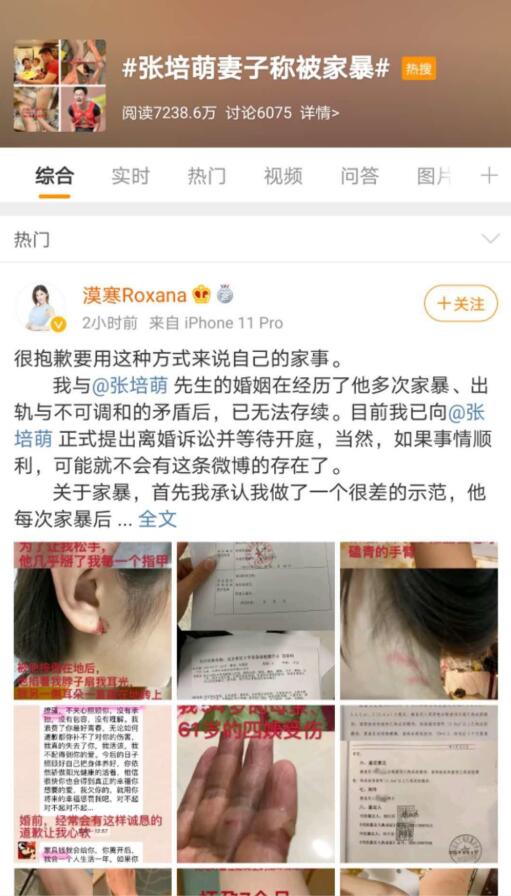 疑点重重!张培萌妻子称只想要女儿抚养权 张培萌发声否认出轨