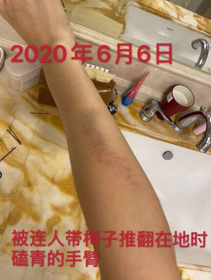 剧情反转!张培萌妻子称只想要女儿抚养权 张培萌婚内出轨抢孩子