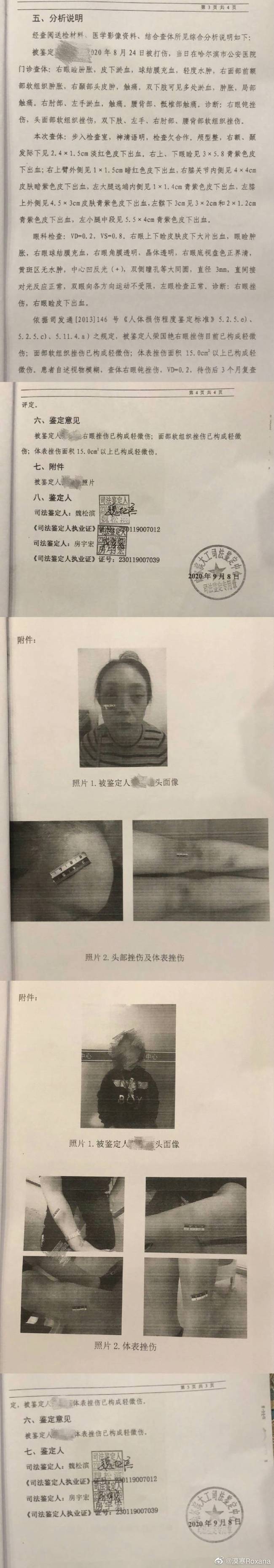 剧情反转!张培萌妻子称只想要女儿抚养权 张培萌婚内出轨抢孩子