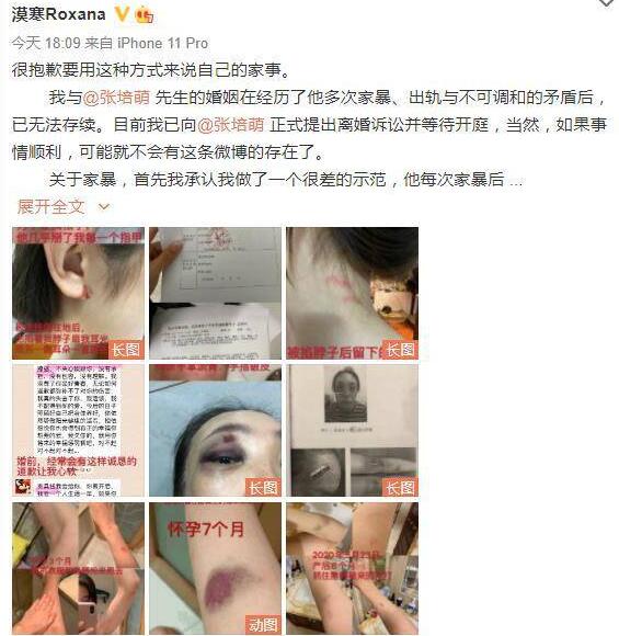 【吃瓜围观】张培萌妻子称只想要女儿抚养权 到底发生了什么?