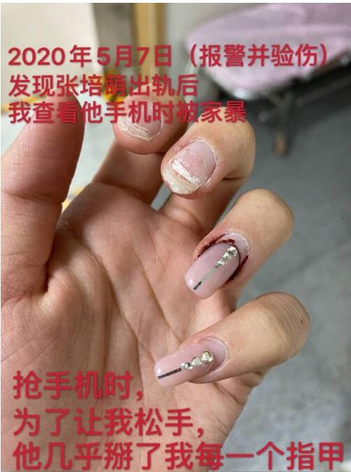 剧情反转!张培萌妻子称只想要女儿抚养权 张培萌婚内出轨抢孩子