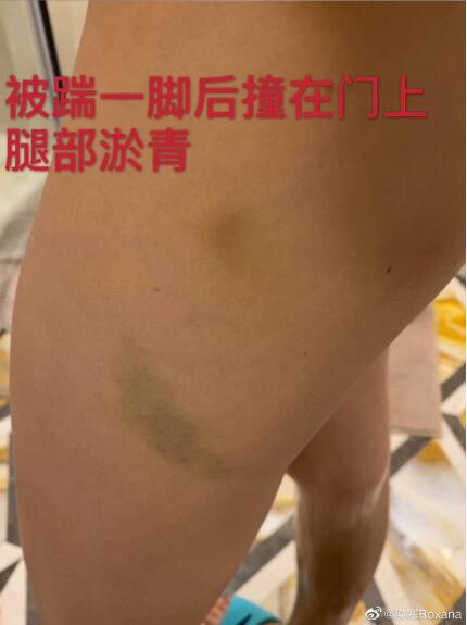 剧情反转!张培萌妻子称只想要女儿抚养权 张培萌婚内出轨抢孩子