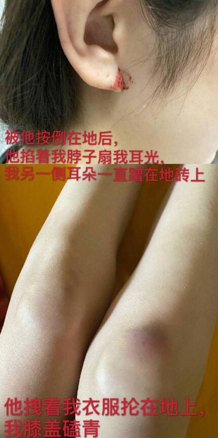 剧情反转!张培萌妻子称只想要女儿抚养权 张培萌婚内出轨抢孩子